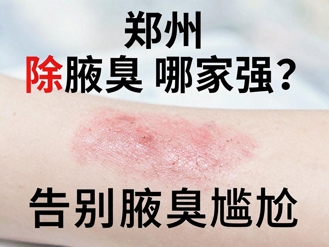 郑州除腋臭哪家强？除腋臭医院选择指南，告别腋臭尴尬