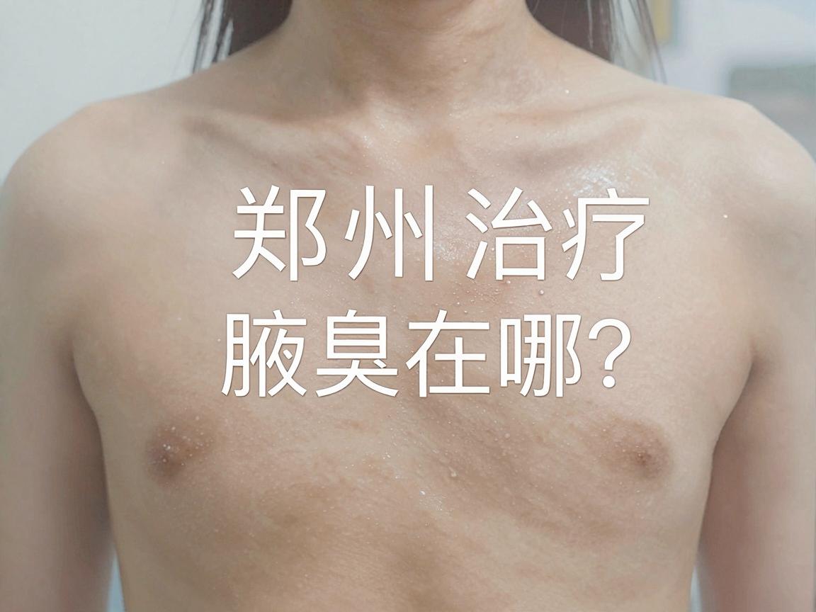 郑州治疗腋臭医院在哪？郑州治疗腋臭选对医院很关键