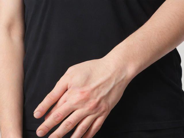 开封去狐臭什么价位？揭秘开封狐臭手术费用与治疗选择
