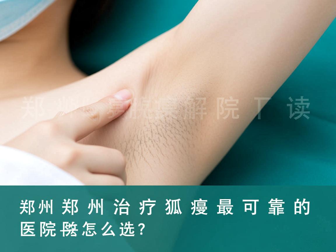 郑州腋臭医院解读，郑州治疗狐臭最可靠的医院怎么选？