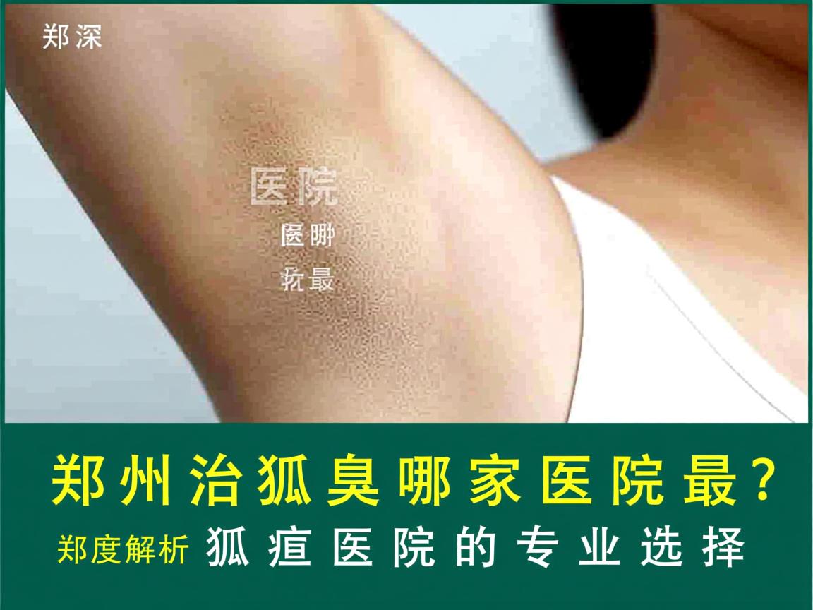 郑州治狐臭哪家医院最好？深度解析郑州狐臭医院的专业选择