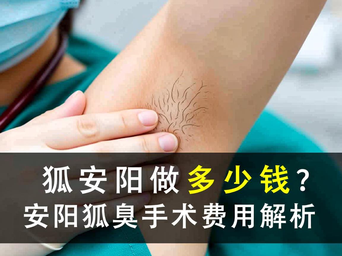 狐臭手术在安阳做多少钱?安阳狐臭手术费用解析 狐臭手术在安阳做多少钱?安阳狐臭手术费用解析