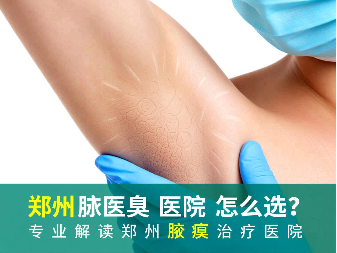 郑州腋臭医院怎么选?专业解读郑州腋臭治疗医院 郑州腋臭医院怎么选?专业解读郑州腋臭治疗医院
