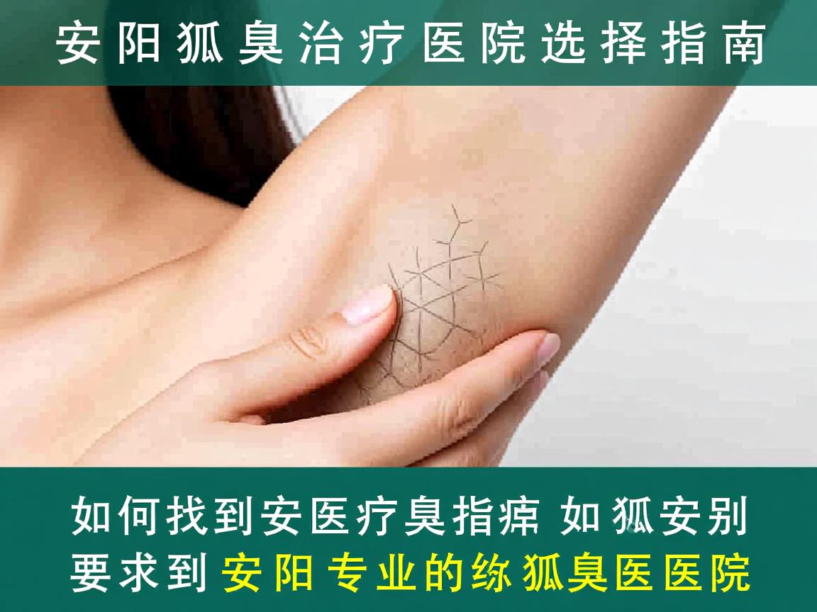 安阳狐臭治疗医院选择指南,如何找到安阳专业的狐臭医院 安阳狐臭治疗医院选择指南,如何找到安阳专业的狐臭医院