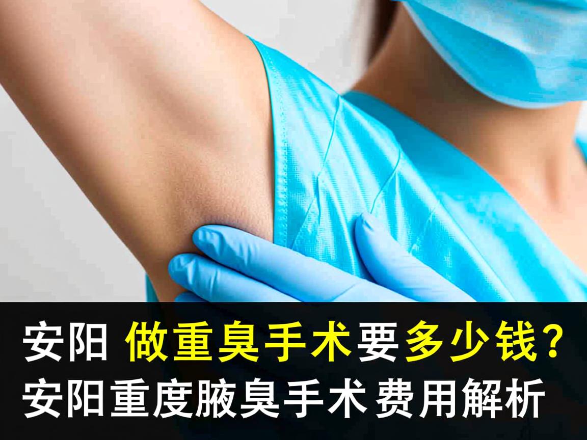 在安阳做重度腋臭手术要多少钱?安阳重度腋臭手术费用解析 在安阳做重度腋臭手术要多少钱?安阳重度腋臭手术费用解析