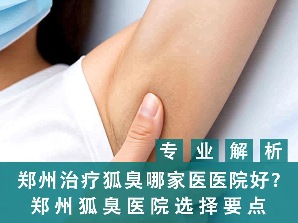 郑州治疗狐臭哪家医院好？专业解析郑州狐臭医院选择要点