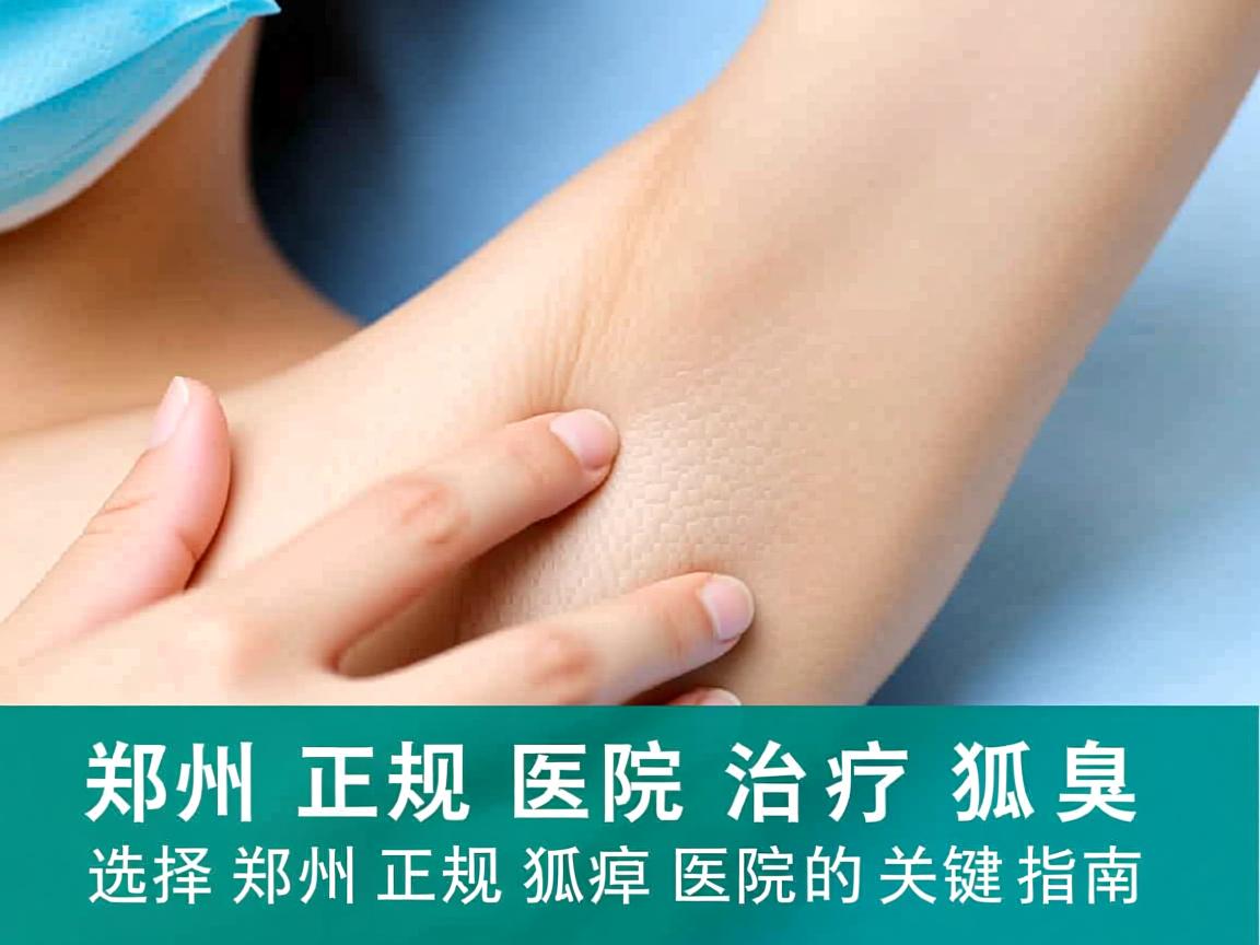 郑州正规医院治疗狐臭，选择郑州正规狐臭医院的关键指南
