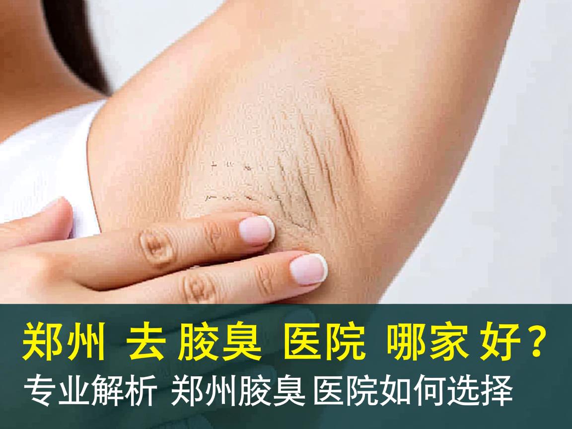 郑州去腋臭医院哪家好？专业解析郑州腋臭医院如何选择