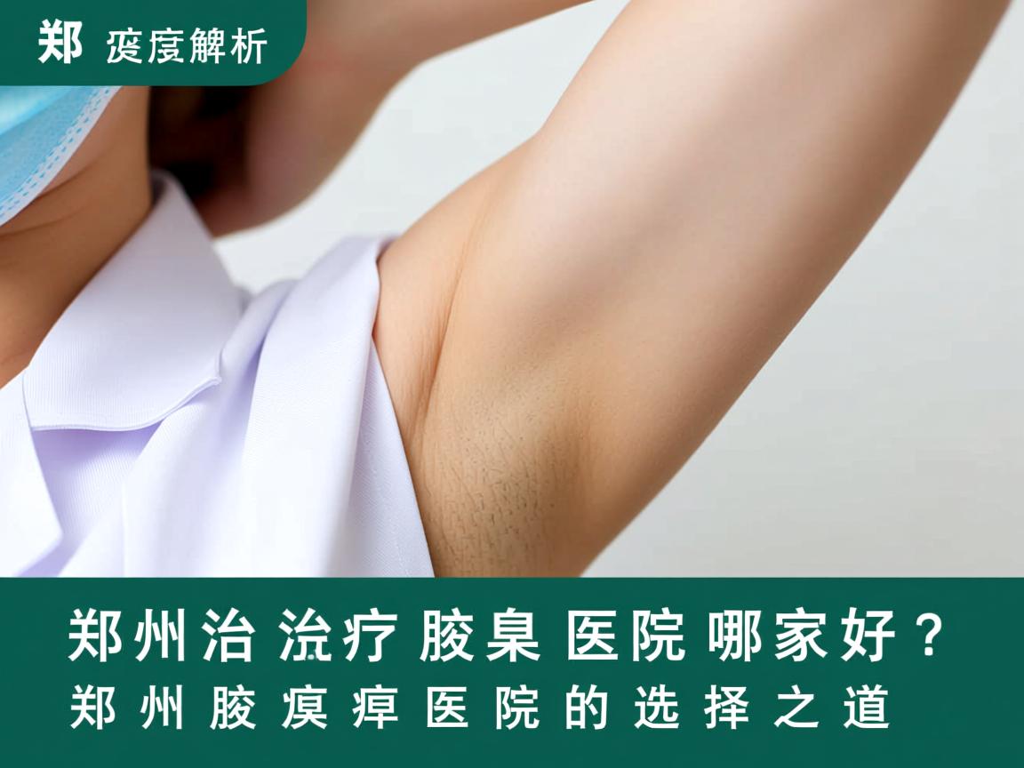 郑州治疗腋臭医院哪家好？深度解析郑州腋臭医院的选择之道