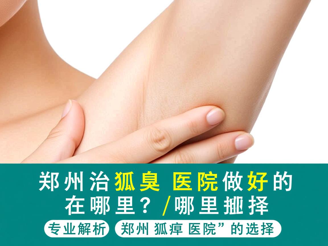 郑州治狐臭医院做好的在哪里？专业解析郑州狐臭医院的选择