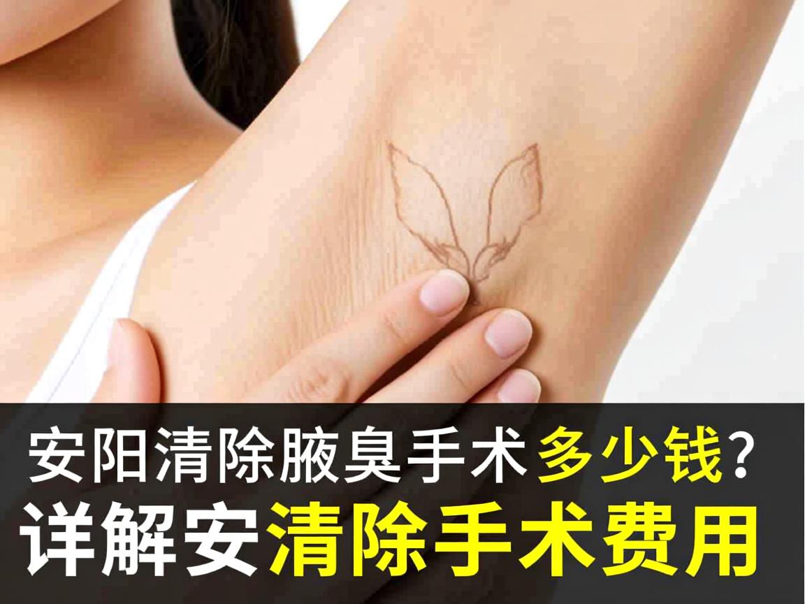 安阳清除腋臭手术多少钱？详解安阳腋臭清除手术费用