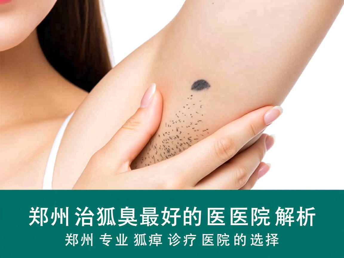 郑州治狐臭最好的医院解析,郑州专业狐臭诊疗医院的选择 郑州治狐臭最好的医院解析,郑州专业狐臭诊疗医院的选择