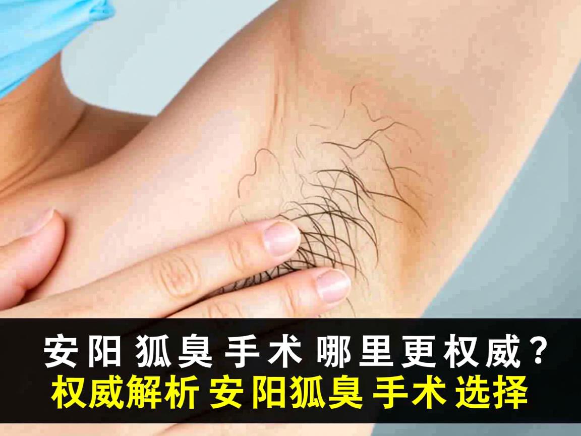 安阳狐臭手术哪里更权威?权威解析安阳狐臭手术选择 安阳狐臭手术哪里更权威?权威解析安阳狐臭手术选择