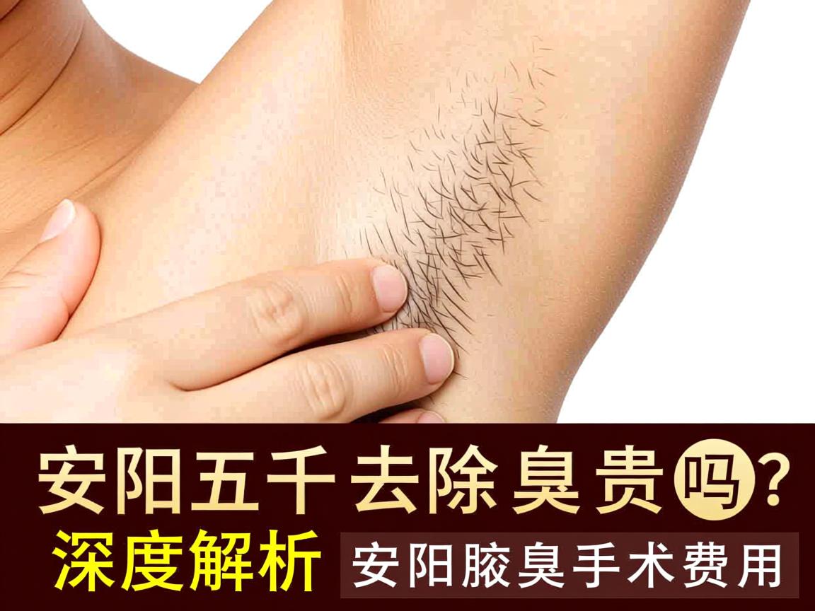 安阳五千去除腋臭贵吗?深度解析安阳腋臭手术费用 安阳五千去除腋臭贵吗?深度解析安阳腋臭手术费用