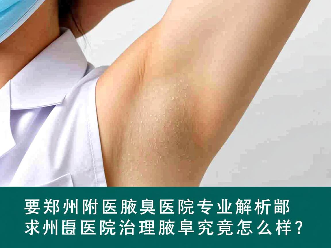 郑州附医腋臭医院专业解析，郑州附医医院治理腋臭究竟怎么样？