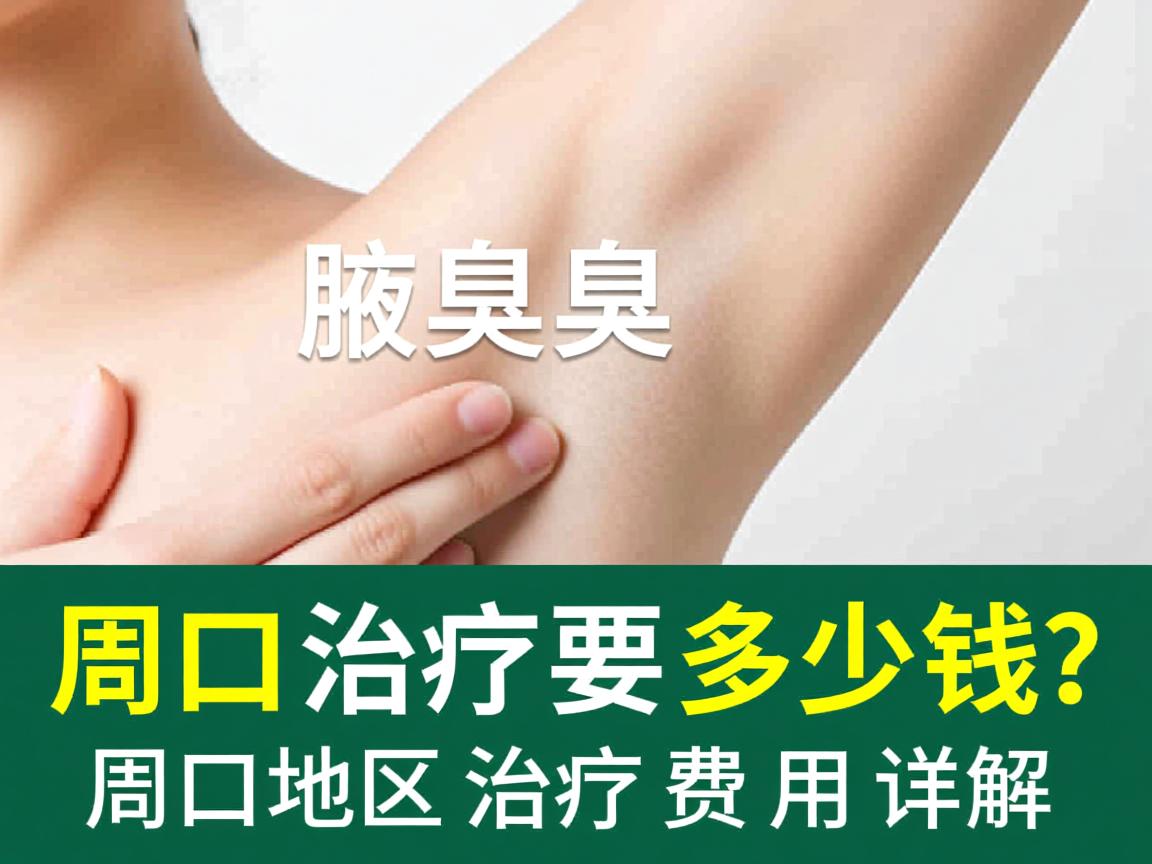 周口腋臭治疗要多少钱?周口地区腋臭治疗费用详解 周口腋臭治疗要多少钱?周口地区腋臭治疗费用详解