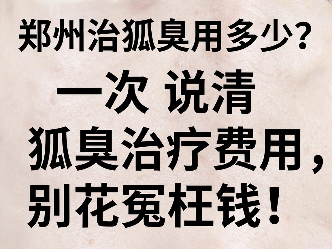 郑州治狐臭费用多少?一次说清狐臭治疗费用,别花冤枉钱! 郑州治狐臭费用多少?一次说清狐臭治疗费用,别花冤枉钱!