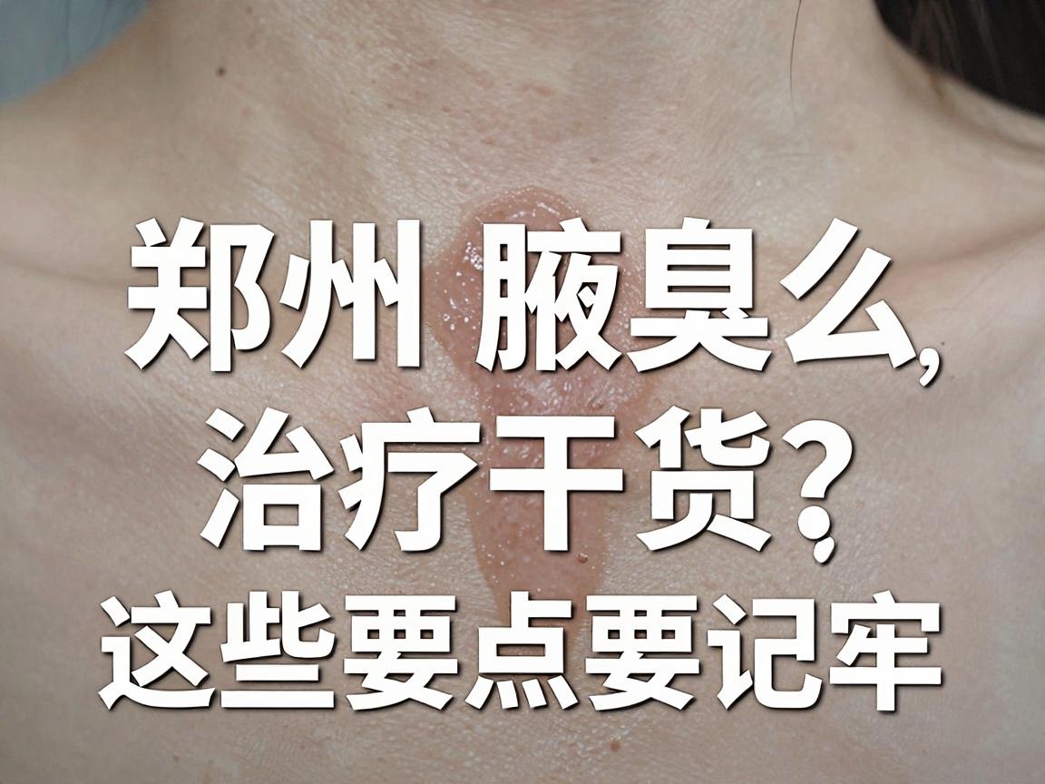 郑州腋臭医院怎么选?郑州腋臭治疗干货,这些要点要记牢 郑州腋臭医院怎么选?郑州腋臭治疗干货,这些要点要记牢