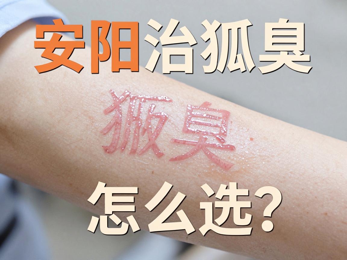 安阳治狐臭专业医院怎么选？安阳治狐臭，别踩这些坑