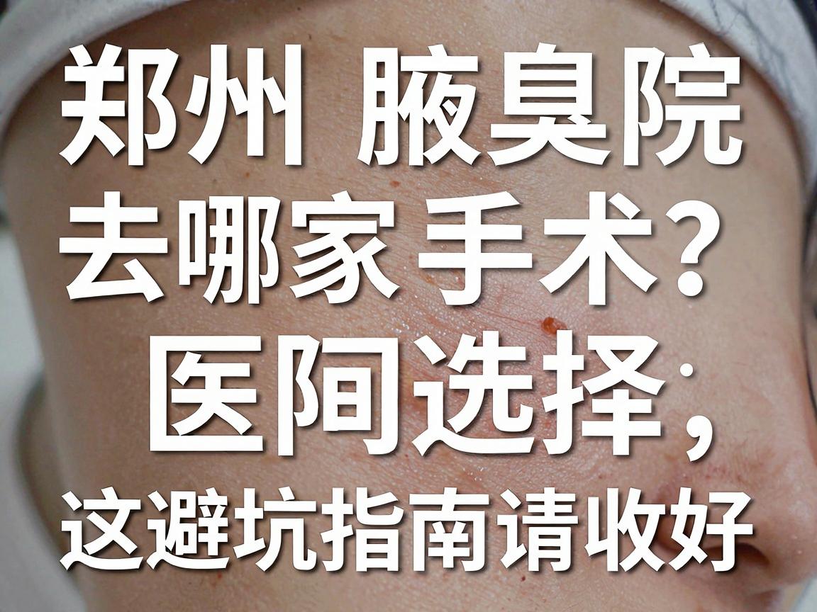 郑州腋臭手术去哪家医院？腋臭手术医院选择，这份避坑指南请收好