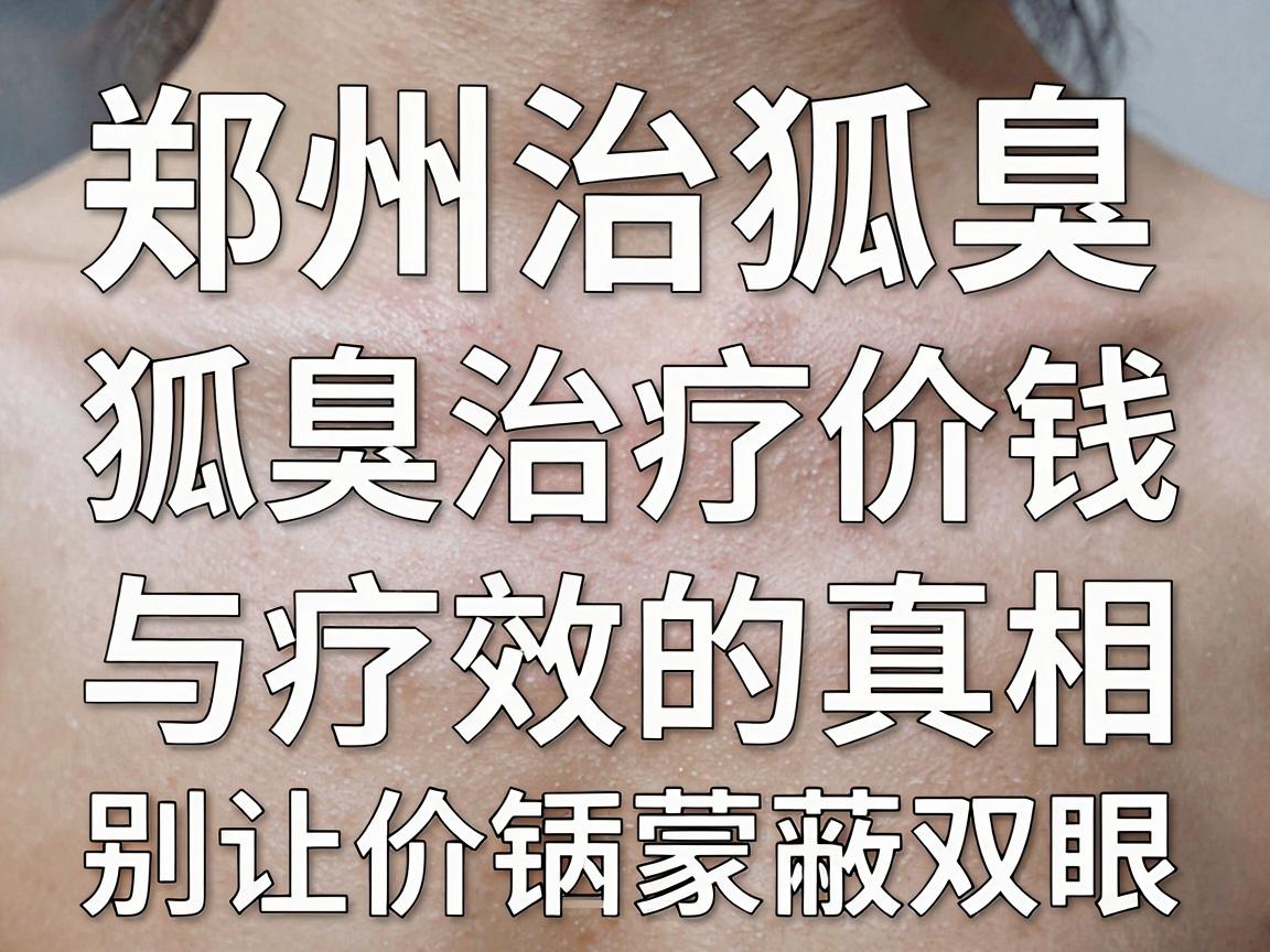 郑州治狐臭价钱公开，狐臭治疗价钱与疗效的真相，别让价钱蒙蔽双眼