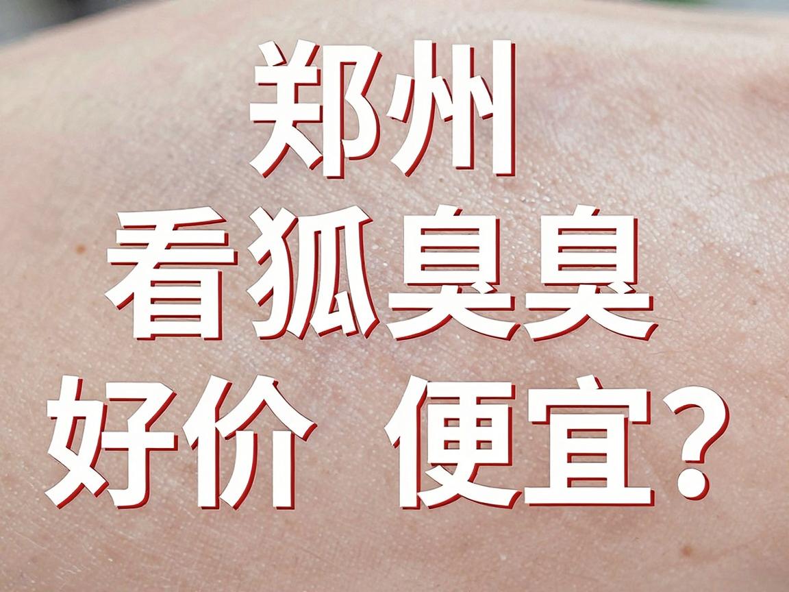 郑州看狐臭好价格便宜?这份省钱攻略请收好,郑州看狐臭不踩坑 郑州看狐臭好价格便宜?这份省钱攻略请收好,郑州看狐臭不踩坑
