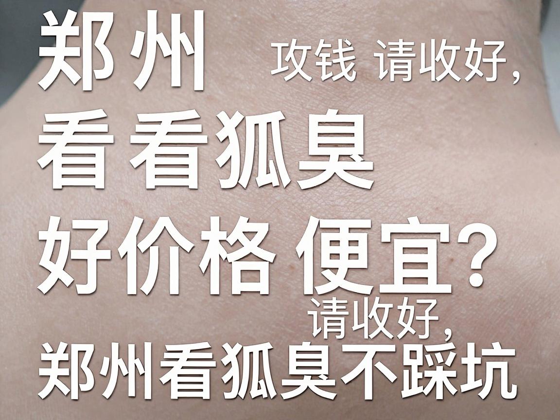郑州看狐臭好价格便宜?这份省钱攻略请收好,郑州看狐臭不踩坑 郑州看狐臭好价格便宜?这份省钱攻略请收好,郑州看狐臭不踩坑