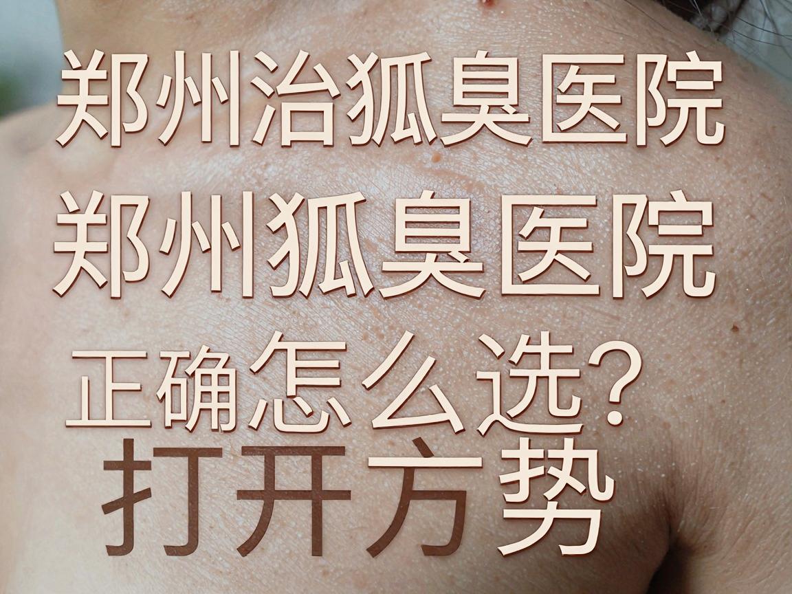 郑州治狐臭医院怎么选？深度解析郑州治狐臭医院的正确打开方式