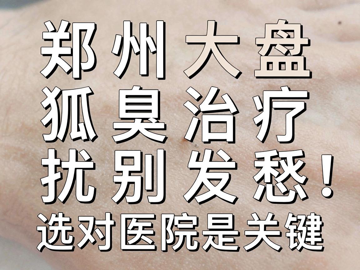 郑州狐臭治疗医院大盘点，狐臭困扰别发愁，选对医院是关键