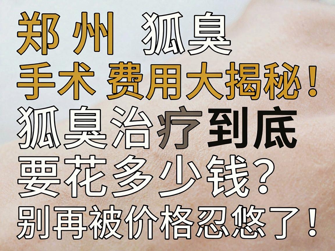 郑州狐臭手术费用大揭秘，狐臭治疗到底要花多少钱？别再被价格忽悠了！