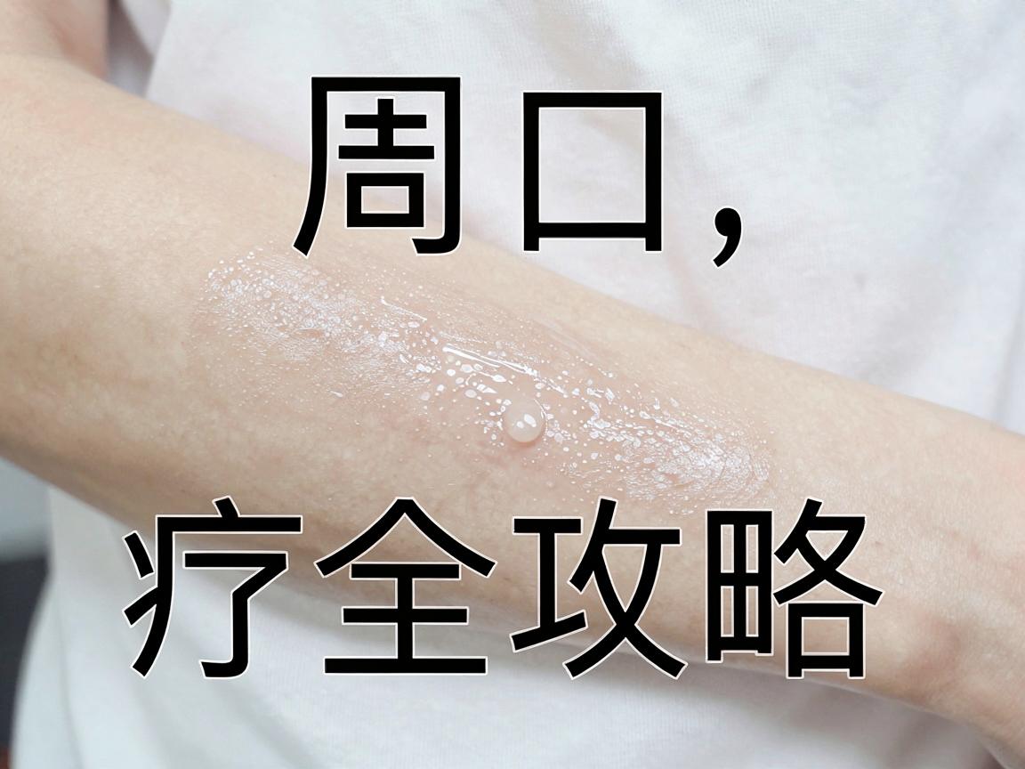 周口腋臭治疗全攻略,从周口医院腋臭最佳方案到日常护理干货 周口腋臭治疗全攻略,从周口医院腋臭最佳方案到日常护理干货