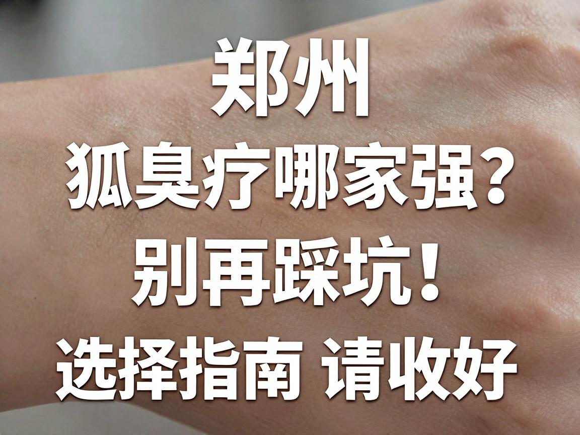 郑州狐臭治疗哪家强？别再踩坑，这份狐臭医院选择指南请收好