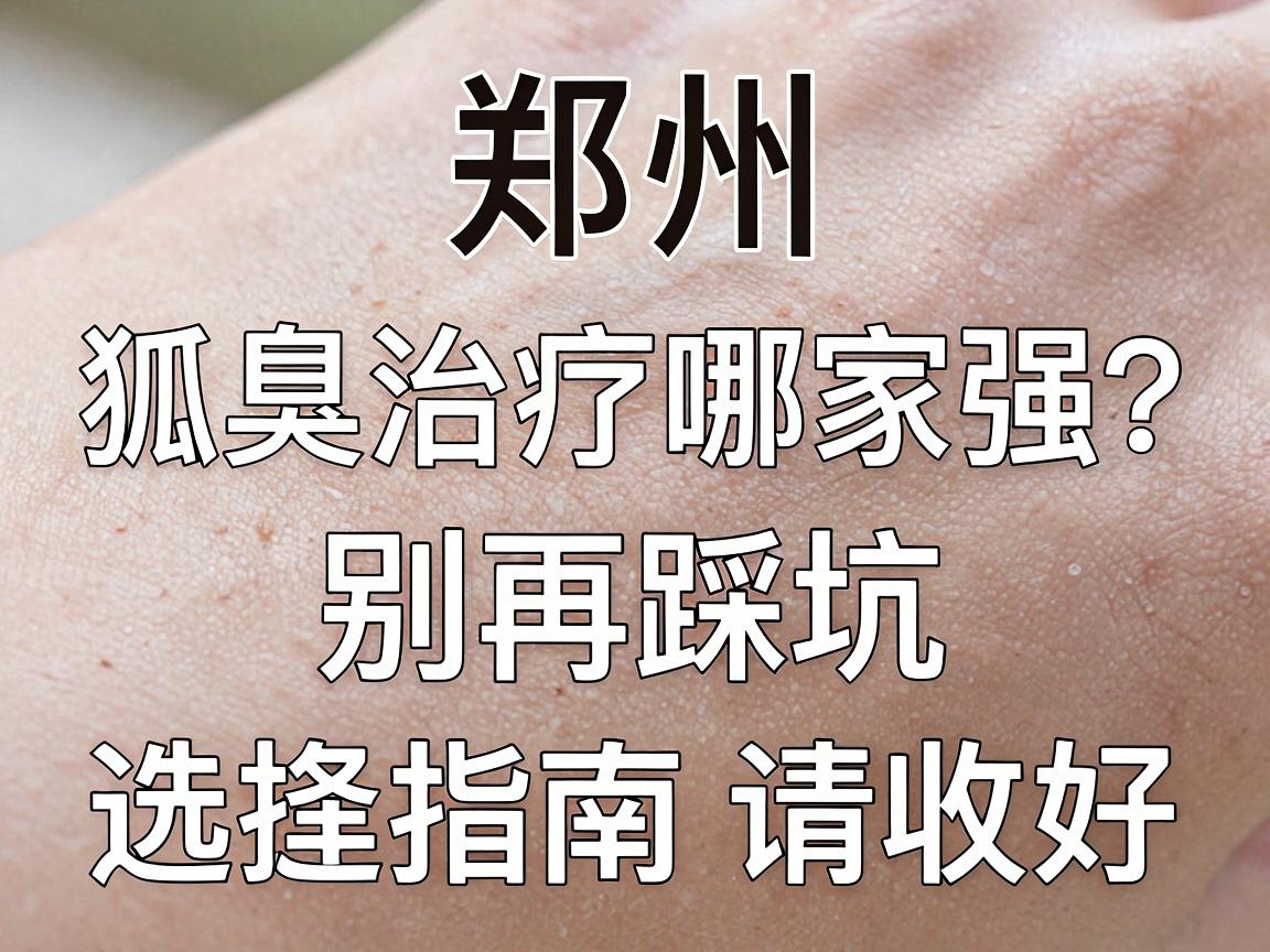 郑州狐臭治疗哪家强？别再踩坑，这份狐臭医院选择指南请收好