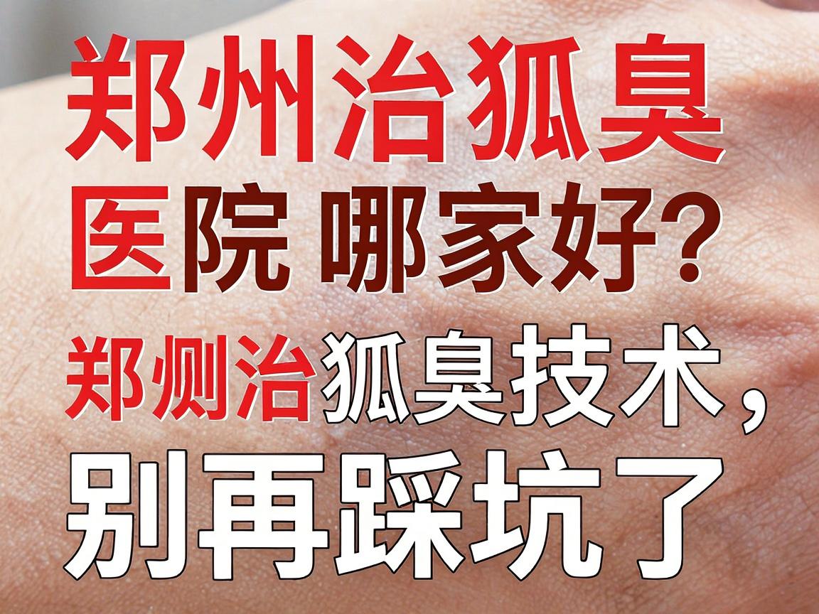 郑州治狐臭医院哪家好？亲测对比郑州治狐臭技术，别再踩坑了