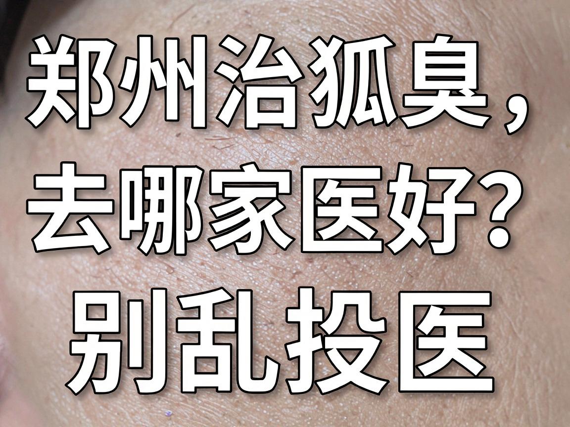 郑州治狐臭去哪家医院好?别乱投医,看这篇郑州医院选择攻略 郑州治狐臭去哪家医院好?别乱投医,看这篇郑州医院选择攻略
