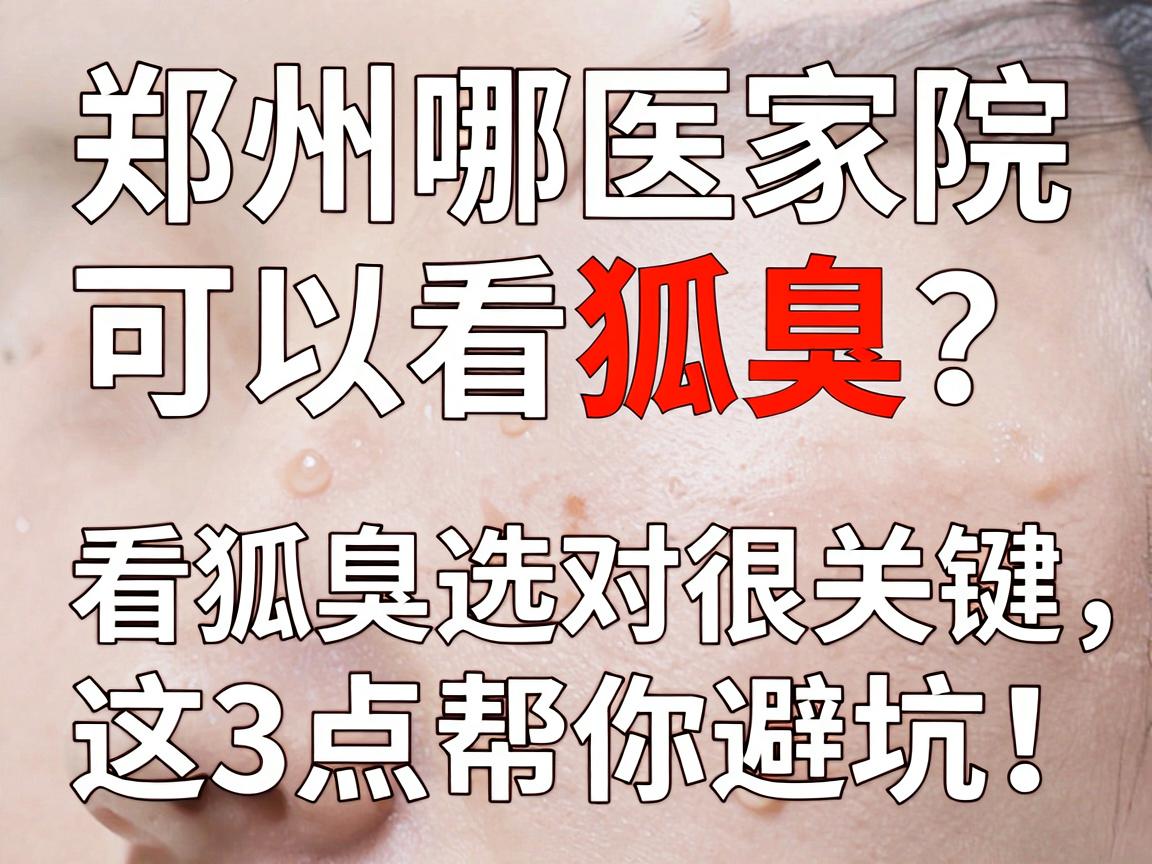 郑州哪家医院可以看狐臭?看狐臭选对医院很关键,这3点帮你避坑! 郑州哪家医院可以看狐臭?看狐臭选对医院很关键,这3点帮你避坑!