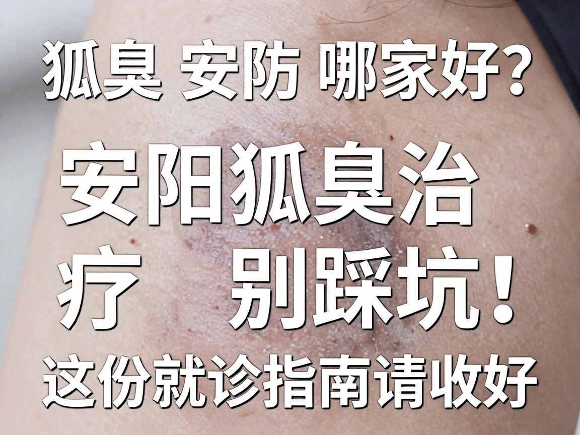 狐臭安阳哪家好?安阳狐臭治疗别踩坑,这份就诊指南请收好 狐臭安阳哪家好?安阳狐臭治疗别踩坑,这份就诊指南请收好